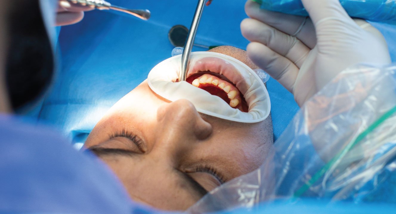 Imagine Chirurgie Dentară